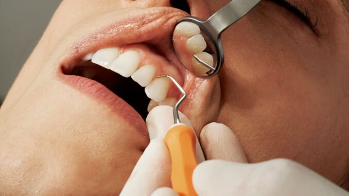 Costa Rica Dental Tourism